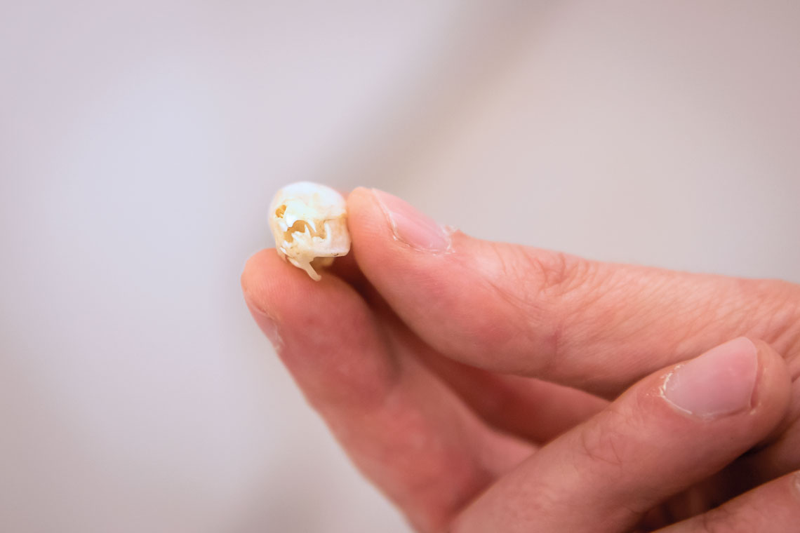 Researcher Henry Pihlström holding a bat skull.